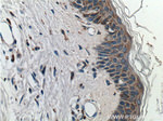 JPH1 Antibody in Immunohistochemistry (Paraffin) (IHC (P))