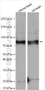 JPH1 Antibody in Western Blot (WB)