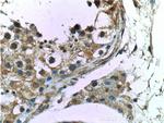 CCDC62 Antibody in Immunohistochemistry (Paraffin) (IHC (P))
