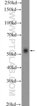 CCDC62 Antibody in Western Blot (WB)