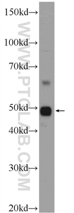 ZDHHC7 Antibody in Western Blot (WB)
