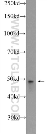 ZDHHC7 Antibody in Western Blot (WB)