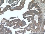 TMEM184A Antibody in Immunohistochemistry (Paraffin) (IHC (P))
