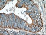 TMEM184A Antibody in Immunohistochemistry (Paraffin) (IHC (P))