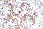 GPR87 Antibody in Immunohistochemistry (Paraffin) (IHC (P))