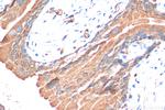 GPR87 Antibody in Immunohistochemistry (Paraffin) (IHC (P))