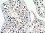 NDUFAF4 Antibody in Immunohistochemistry (Paraffin) (IHC (P))