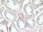 NDUFAF4 Antibody in Immunohistochemistry (Paraffin) (IHC (P))