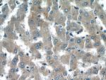 NDUFAF4 Antibody in Immunohistochemistry (Paraffin) (IHC (P))
