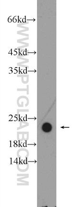 NDUFAF4 Antibody in Western Blot (WB)