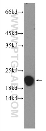 NDUFAF4 Antibody in Western Blot (WB)