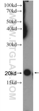 NDUFAF4 Antibody in Western Blot (WB)