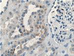 BRAP Antibody in Immunohistochemistry (Paraffin) (IHC (P))
