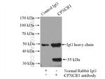 CPXCR1 Antibody in Immunoprecipitation (IP)