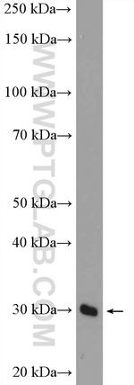 CPXCR1 Antibody in Western Blot (WB)