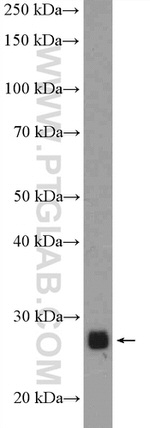 CPXCR1 Antibody in Western Blot (WB)