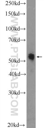 TRMT61B Antibody in Western Blot (WB)