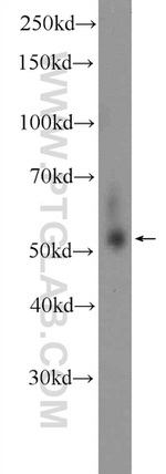 TRMT61B Antibody in Western Blot (WB)