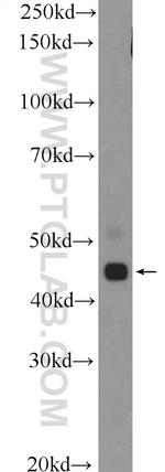TTLL10 Antibody in Western Blot (WB)
