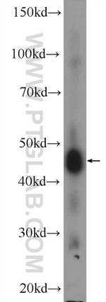 TTLL10 Antibody in Western Blot (WB)