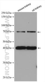 RNF128 Antibody in Western Blot (WB)