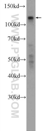KIAA0090 Antibody in Western Blot (WB)
