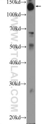 HISPPD1 Antibody in Western Blot (WB)