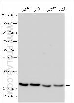 ZCCHC13 Antibody in Western Blot (WB)