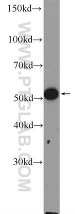 CHRNA9 Antibody in Western Blot (WB)