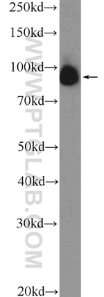 C2orf3 Antibody in Western Blot (WB)