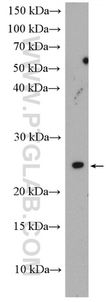 C3orf34 Antibody in Western Blot (WB)