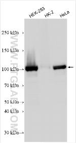 MLC1 Antibody in Western Blot (WB)
