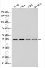 RTN4RL2 Antibody in Western Blot (WB)