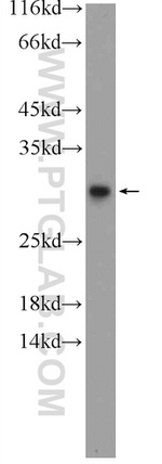 C20orf20 Antibody in Western Blot (WB)