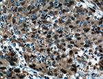 C20orf20 Antibody in Immunohistochemistry (Paraffin) (IHC (P))