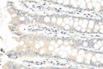 RNF141 Antibody in Immunohistochemistry (Paraffin) (IHC (P))