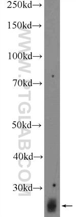 RNF141 Antibody in Western Blot (WB)
