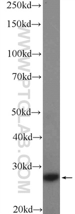CFD Antibody in Western Blot (WB)