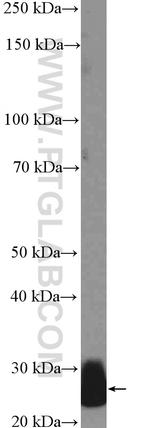 CFD Antibody in Western Blot (WB)