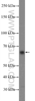 ITPRIP Antibody in Western Blot (WB)