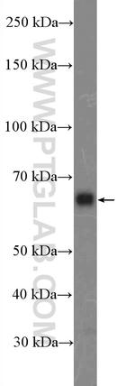 ITPRIP Antibody in Western Blot (WB)