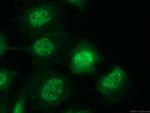 SLFN11 Antibody in Immunocytochemistry (ICC/IF)