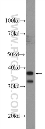 UBXN10 Antibody in Western Blot (WB)