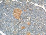 UBR1 Antibody in Immunohistochemistry (Paraffin) (IHC (P))