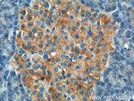 UBR1 Antibody in Immunohistochemistry (Paraffin) (IHC (P))