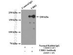 UBR1 Antibody in Immunoprecipitation (IP)