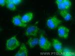 DUSP6 Antibody in Immunocytochemistry (ICC/IF)
