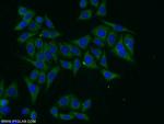 PARP10 Antibody in Immunocytochemistry (ICC/IF)