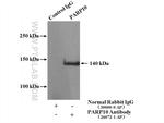 PARP10 Antibody in Immunoprecipitation (IP)
