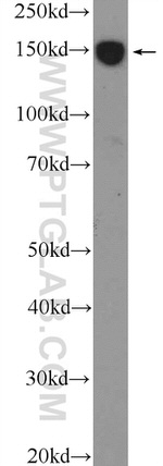 PARP10 Antibody in Western Blot (WB)